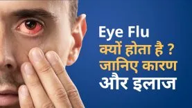 eye flu symptoms,eye flu,eye flu treatment,eye flu ke lakshan,eye flu home remedies,eye flu kaise hota hai,eye flu hone par kya karen,eye flu kaise thik kare,eye flu disease,eye flu news,what is eye flu,eye flu treatment in hindi,eye fluid problems,eye flu types,eye flu outbreak,symptoms of eye flu,eye flu in baby,causes of eye flu,eye flu symptoms and treatment,eye fluttering,eye flu ka ilaj,home remedies for eye flu,eye flu kya hota ha